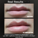 REVISION YOUTHFULL LIP REPLENISHER - 02