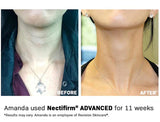 REVISION NECTIFIRM ADVANCED - Img 03