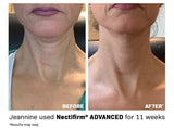 REVISION NECTIFIRM ADVANCED - Img 02
