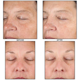 Face Cream
