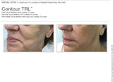 Contour TRL Laser