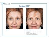 Contour TRL Laser
