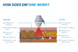 Emtone