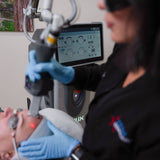 HELIX C02 Laser Resurfacing Treatment