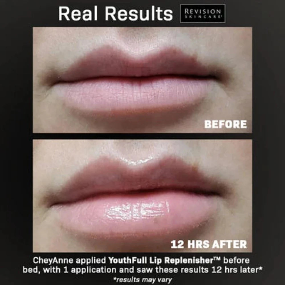 Revision リビジョン Lip Replenisher 2本セット リビジョン ユースフルリップ Youthfull Lip Replenisher