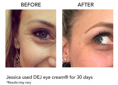 Revision DEJ Eye Cream – Texas Dermatology Med Spa