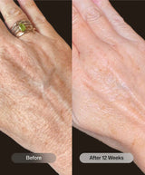 Revision Youthful Hands