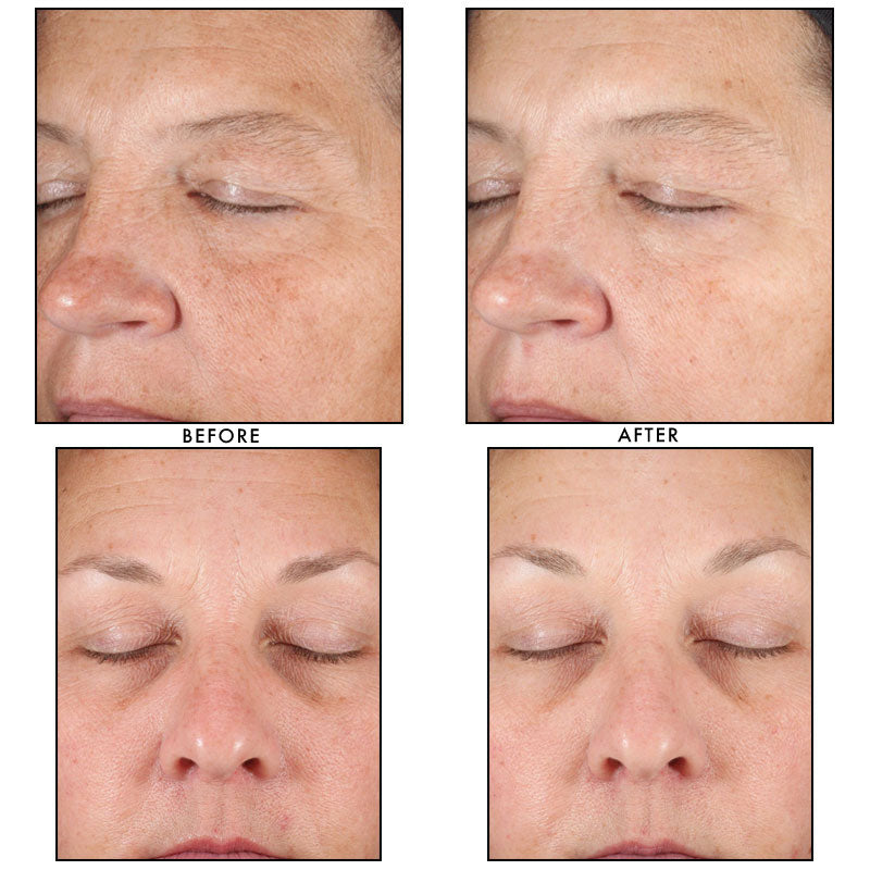 Revision DEJ Face Cream – Texas Dermatology Med Spa