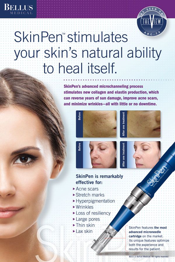 SkinPen Microneedling Treatment